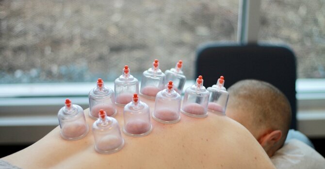 Cupping